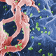 Illustration for article titled A second child may have been cured of HIV
